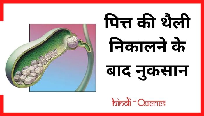 पित्त की थैली निकालने के बाद नुकसान | Gallbladder removal side effects in hindi
