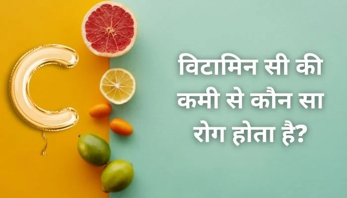विटामिन सी की कमी से कौन सा रोग होता है?