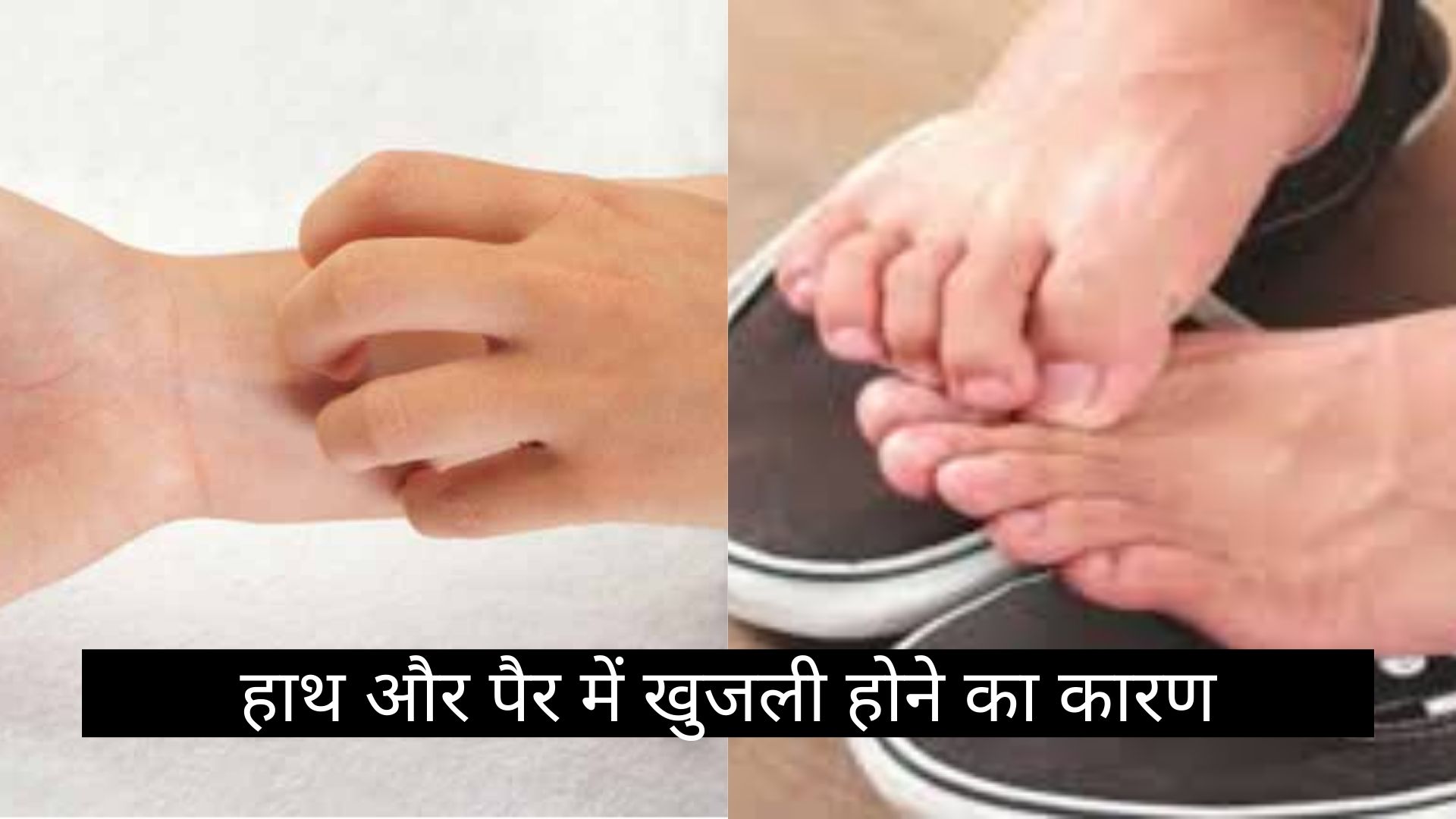 हाथ और पैर में खुजली होने का कारण